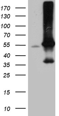 Pepsinogen II (PGC) antibody