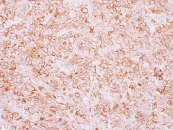 Anti-TEM8 antibody used in IHC (Paraffin sections) (IHC-P). GTX116952