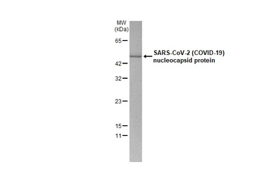 SARS-CoV-2 (COVID-19) Nucleocapsid protein, His tag. GTX135357-pro