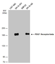 Anti-PDGF Receptor beta antibody used in Western Blot (WB). GTX133587