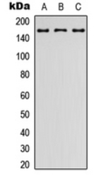 Anti-Latrophilin 2 antibody used in Western Blot (WB). GTX55247