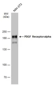 Anti-PDGF Receptor alpha antibody used in Western Blot (WB). GTX133619