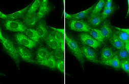 Anti-PDGF Receptor alpha antibody used in Immunocytochemistry/ Immunofluorescence (ICC/IF). GTX133619