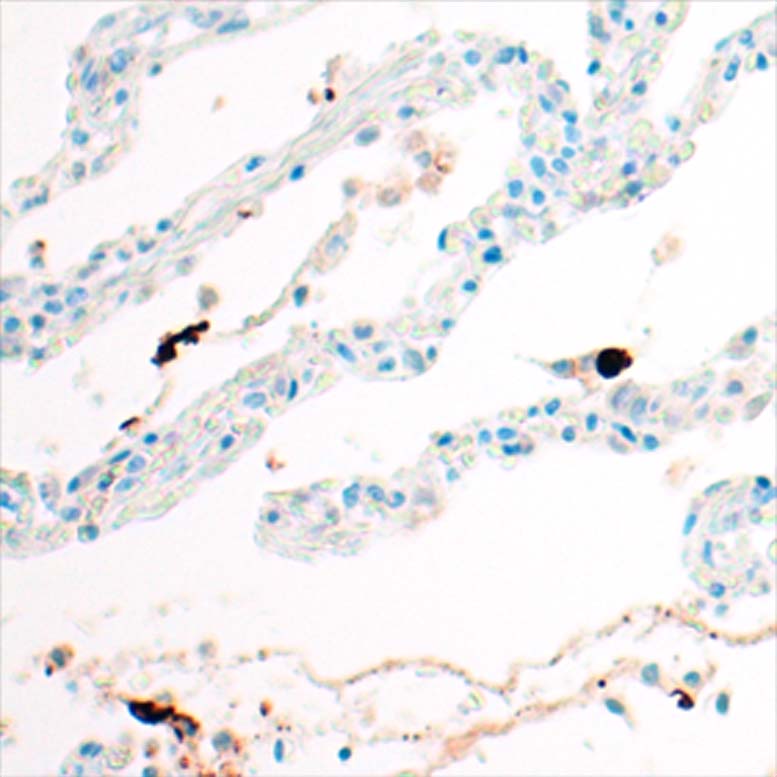 Immunohistochemistry Anti SARS-CoV-2 Antibody S2 IHC-184007 (Klon HL1038 )