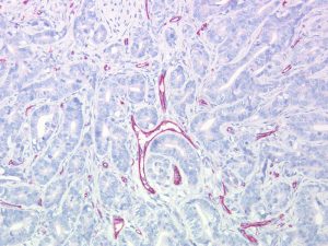 Immunohistochemical staining (IHC) with anti-CD31 (PECAM-1) Antibody (clone SZ31) - dianova