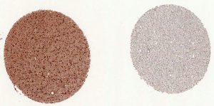 Strong reaction of IDH1 mutation specific antibody clone H09 with IDH1 R132H mutated diffuse astrocytoma (left) but not with wild type tumor (right).