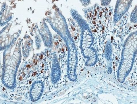 analysis of lipopolysaccharide core in paraffin-embedded rhesus macaques colon tissue using mAb WN1 222-5 (Cat.# HM6011). Images are kindly provided by Dr. Jacob D. Estes, AIDS & Cancer Virus Program, SAIC-Frederick Inc., Frederick National Laboratory for