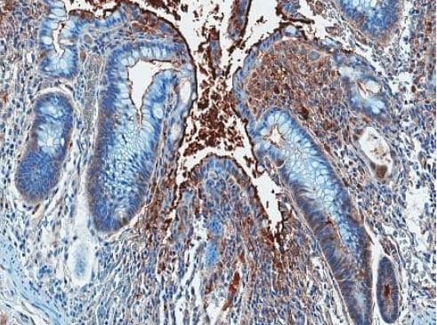 analysis of lipopolysaccharide core in paraffin-embedded rhesus macaques colon tissue using mAb WN1 222-5 (Cat.# HM6011). Images are kindly provided by Dr. Jacob D. Estes, AIDS & Cancer Virus Program, SAIC-Frederick Inc., Frederick National Laboratory for