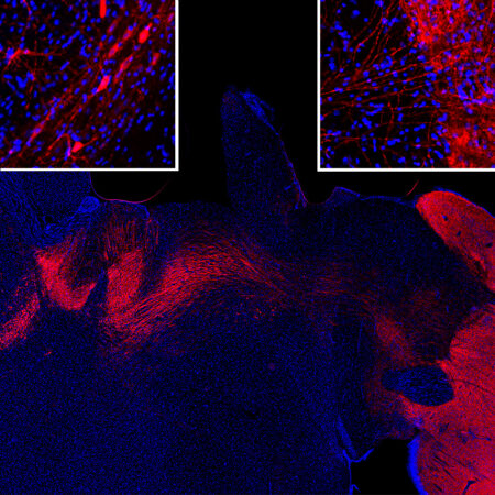 Immunofluorescence