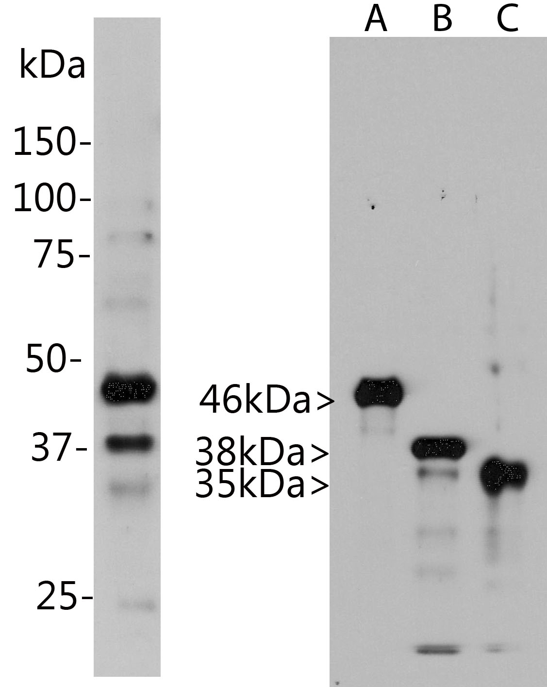 Western blot analysis of Aurora A/B/C (MO22139) kinase in HeLa cells