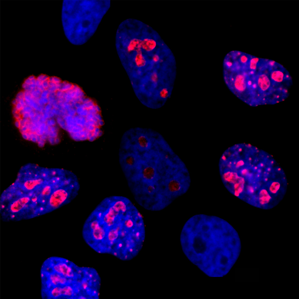 Ki67 Immunofluorescence