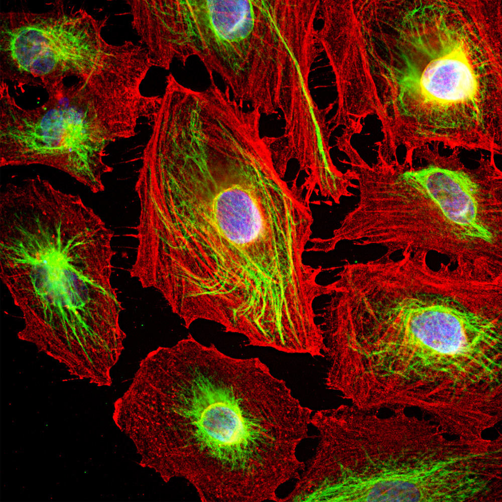 Immunofluorescence