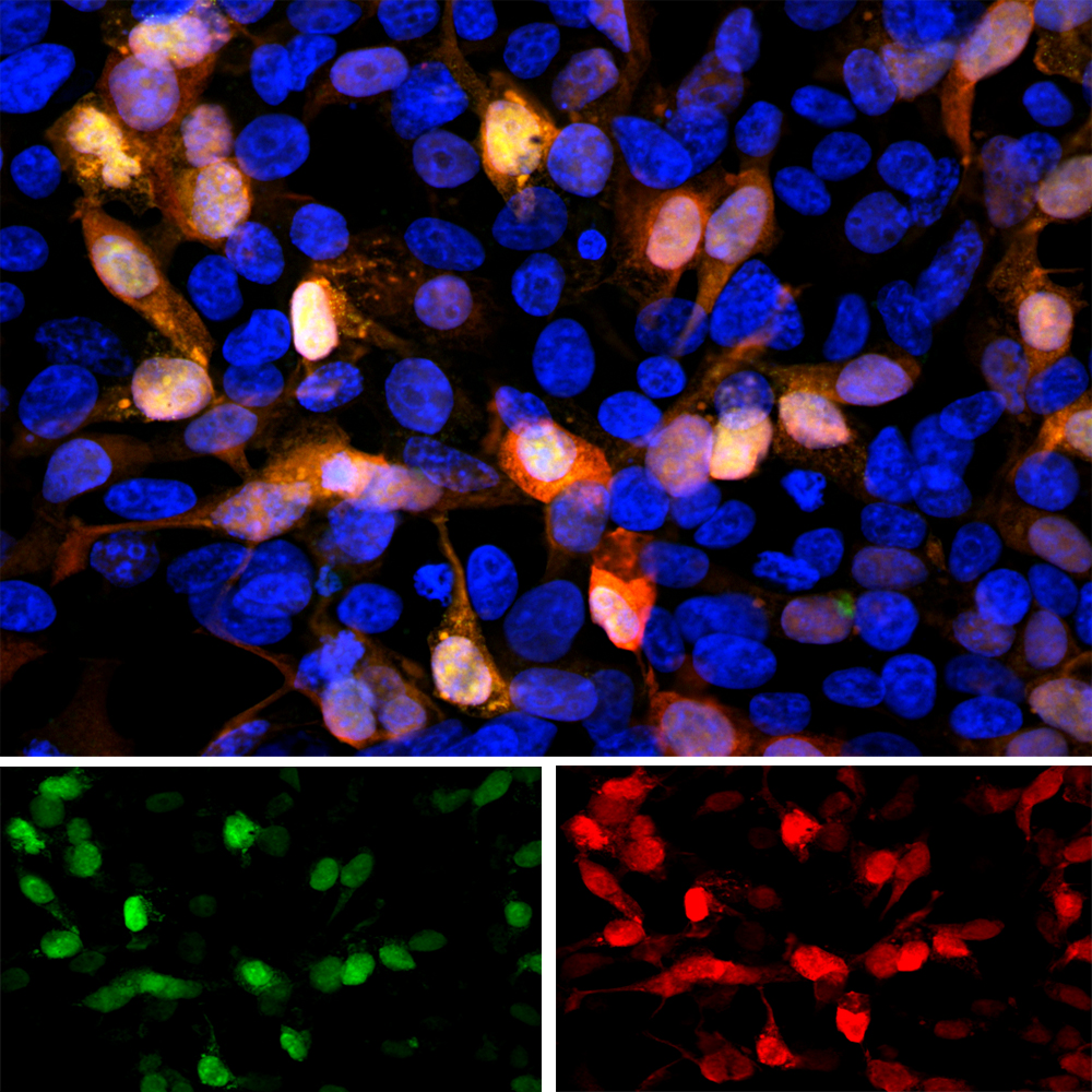 Immunofluorescent