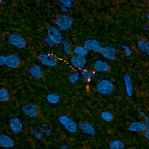 Immunohistochemistry