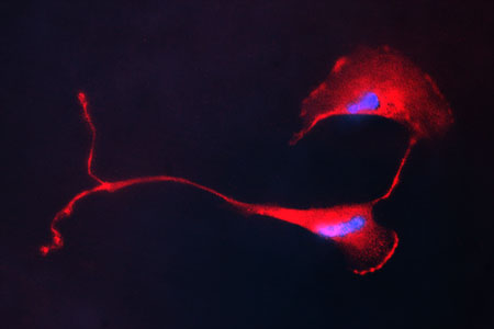 Schwann Cells stained with s100 antibody (red) and DAPI (blue).