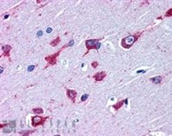 Alsin (dilution: 3.8µg/ml) staining of human brain tissue, cortex (formalin-fixed paraffin-embedded) at 5 ug/ml followed by biotinylated horse anti-goat IgG secondary antibody,  alkaline phosphatase-streptavidin and chromogen. Protocol on data-sheet.