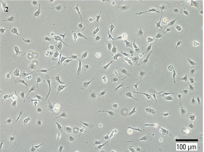 Immortalized Human Microglia in Contrast phase 100X.