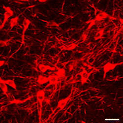 TH staining of neurons in the mouse SNc.