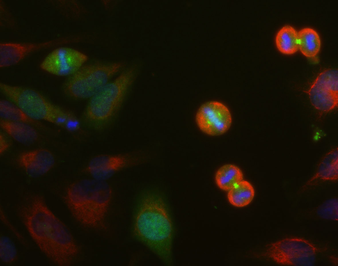 HeLa cell cultures were stained with Aurora A/B/C kinase antibody (green).