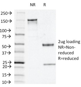 SDS-PAGE Analysis of Purified Thymidine Phosphorylase / PD-ECGF Mouse Monoclonal Antibody (P-GF.44C). Confirmation of Integrity and Purity of Antibody