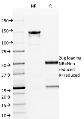 SDS-PAGE Analysis of Purified ETS1 Mouse Monoclonal Antibody (ETS1/1801). Confirmation of Integrity and Purity of Antibody.