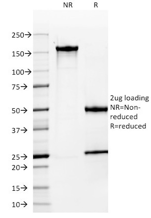 SDS-PAGE Analysis Purified MUC-1 / CA15-3 / EMA Mouse Monoclonal Antibody (MUC1/955).