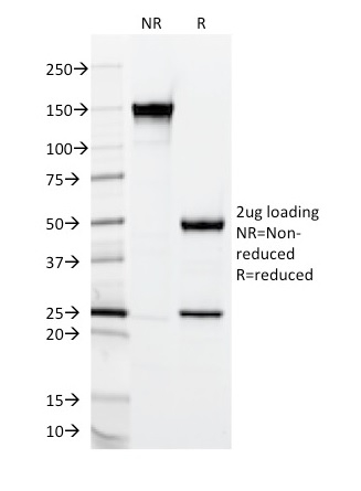 SDS-PAGE Analysis of Purified MUC2 Mouse Monoclonal Antibody (CCP58).  Confirmation of Integrity and Purity of Antibody