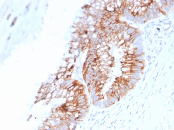 Formalin-fixed, paraffin-embedded human colon stained with MUC2 Mouse Monoclonal Antibody (SPM513).