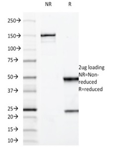 SDS-PAGE Analysis Purified MUC3 Mouse Monoclonal Antibody (M3.1). Confirmation of Integrity and Purity of Antibody.
