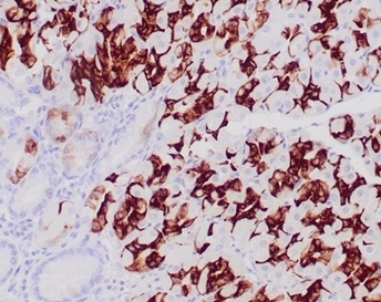 Formalin-fixed, paraffin-embedded human normal stomach. Strong cytoplasmic of glandular cells using MUC6 Mouse Monoclonal Antibody (CLH5). HIER: Tris/EDTA, pH9.0, 45min. 2°C: HRP-polymer, 30min. DAB, 5min.