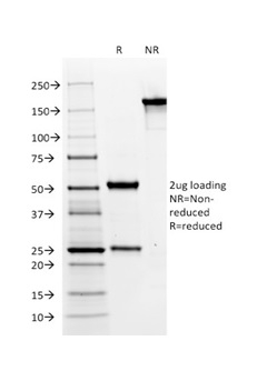 SDS-PAGE Analysis of Purified MUC6 Mouse Monoclonal Antibody (CLH5). Confirmation of Integrity and Purity of Antibody