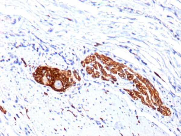 Formalin-fixed, paraffin-embedded human Colon Ganglion stained with CD56 Monoclonal Antibody (123C3.D5 + 123A8)