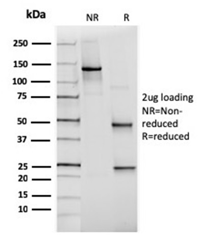 SDS-PAGE Analysis Purified PAX6 Mouse Monoclonal Antibody (PAX6/498). Confirmation of Purity and Integrity of Antibody.