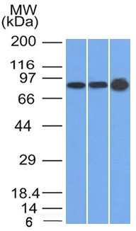 Western Blot of U87, HeLa and A431 cell lysates using Plakophilin-1 Mouse Monoclonal Antibody (10B2)