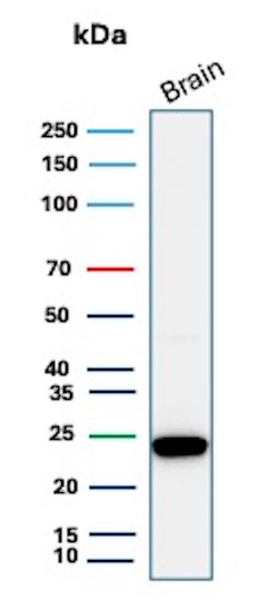 PGP9.5 / UchL1 Antibody in Western Blot (WB)