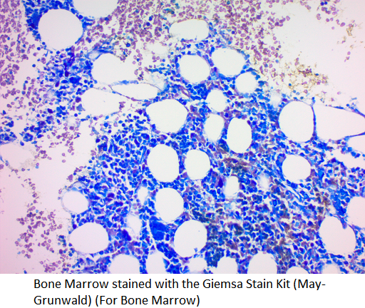 Giemsa Stain Kit (May-Grunwald)