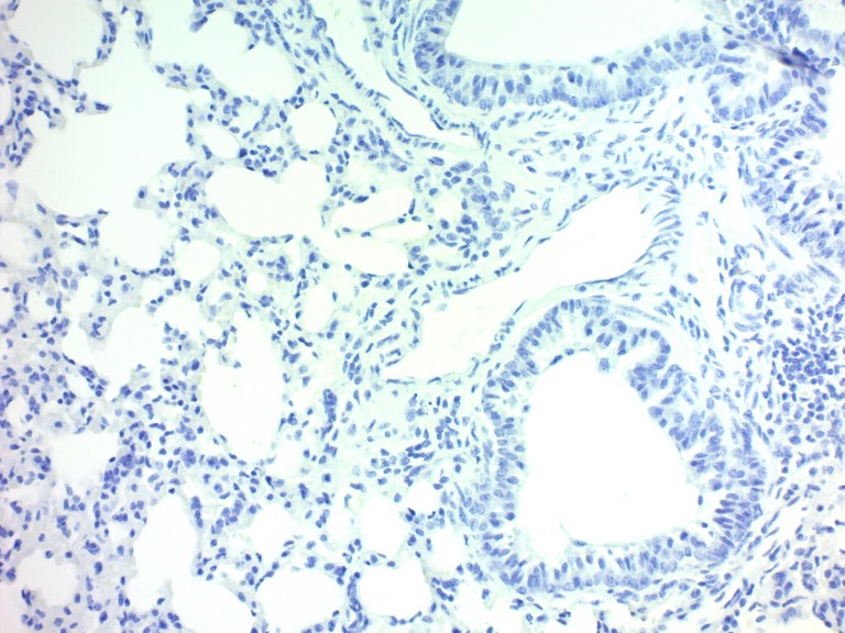 Hematoxylin, Mayer's (Lillie's Modification)