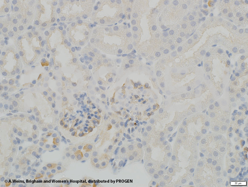 anti-Synaptopodin/SYNPO (internal N-terminus) guinea pig polyclonal, serum