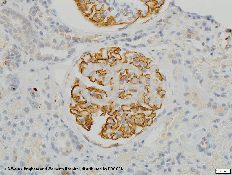 anti-Synaptopodin/SYNPO (N-terminus) guinea pig polyclonal, serum