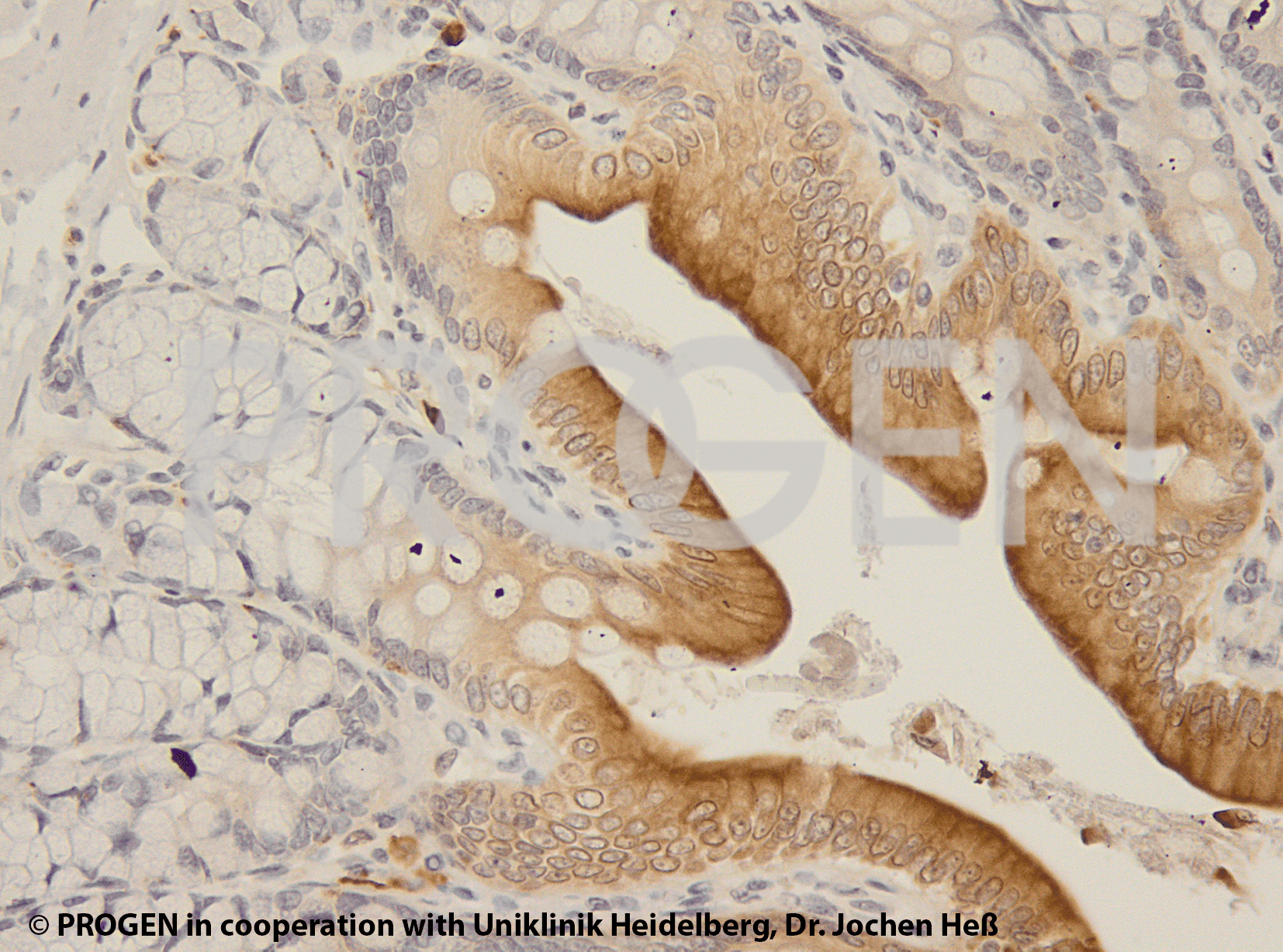 anti-Perilipin 2 (N-terminus) mouse monoclonal, AP125, liquid, purified, sample