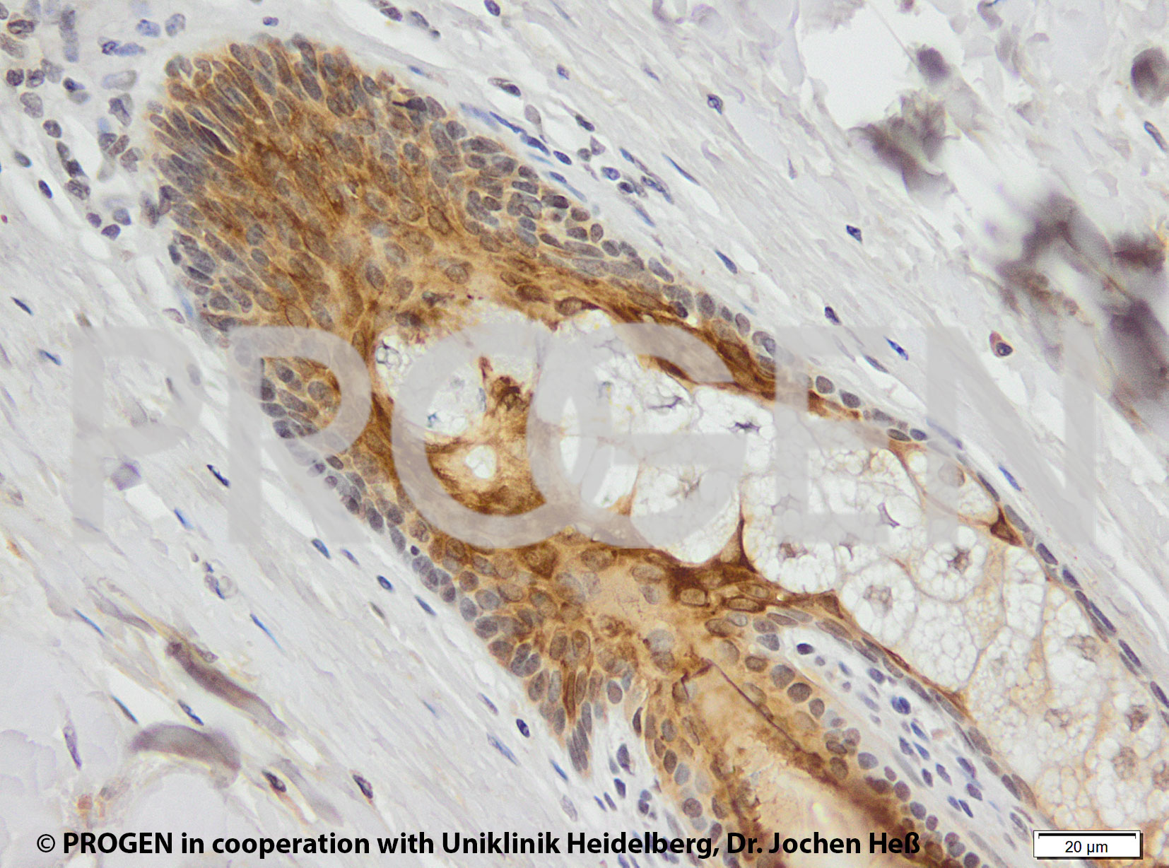 anti-Keratin K6 mouse monoclonal, KA12, lyophilized, purified