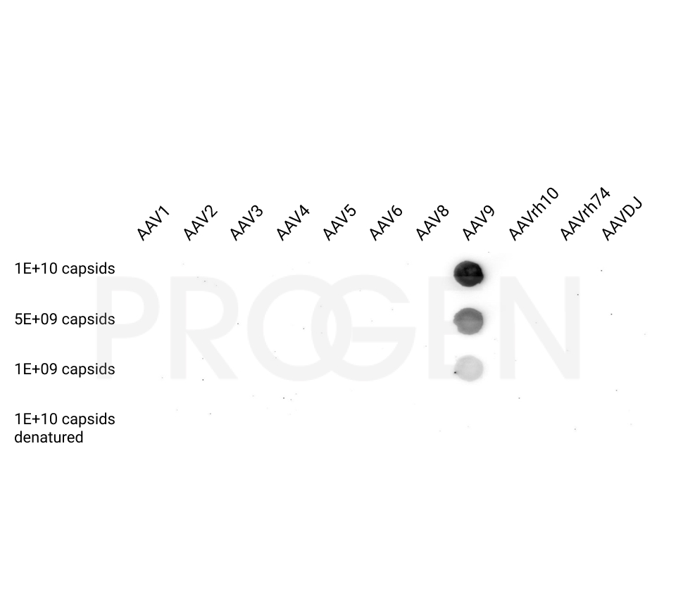 anti-AAV9, human chimeric, ADK9-h1