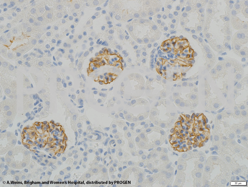 anti-Synaptopodin/SYNPO (internal) guinea pig polyclonal, serum