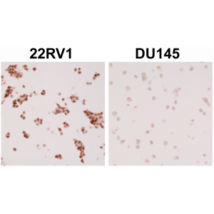 Immunohistochemical