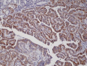 Immunohistochemical