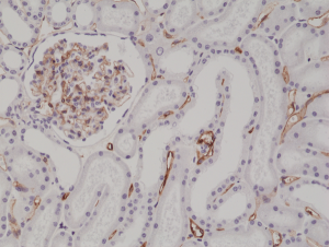 Immunohistochemical