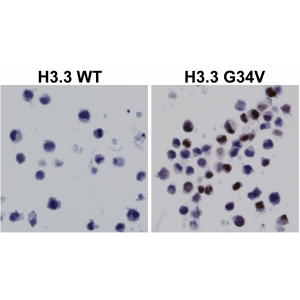 Immunohistochemical