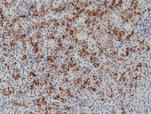 Immunohistochemical