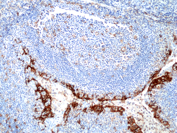 Immunohistochemical