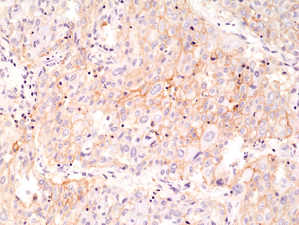 Immunohistochemical